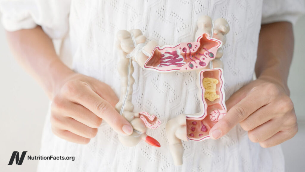 What foods help leaky gut? What foods help leaky gut?