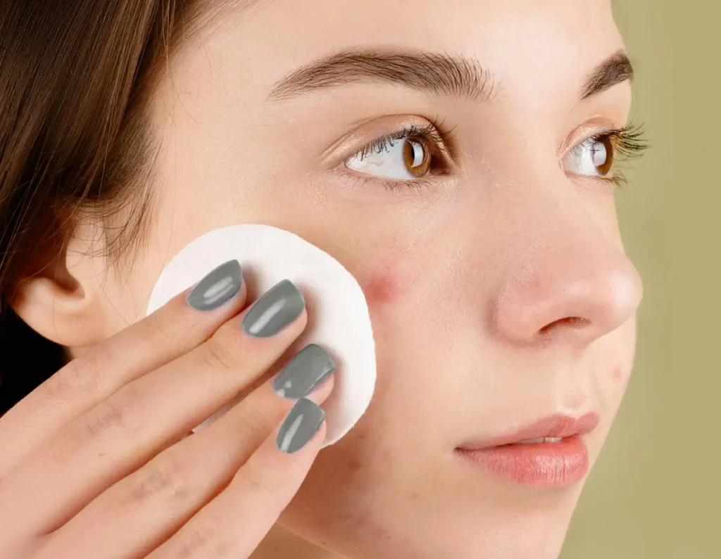 Should salicylic acid burn? – beautiful with mind Should salicylic acid burn? - beautiful with mind