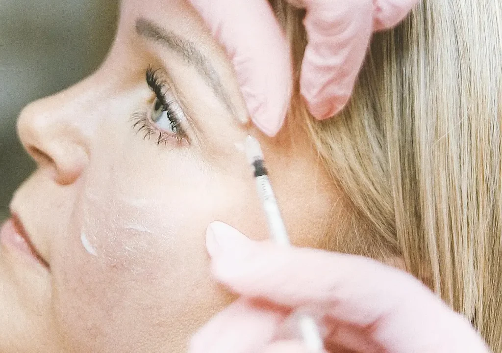 What are the best places to put Botox on the face? - beautiful with mind