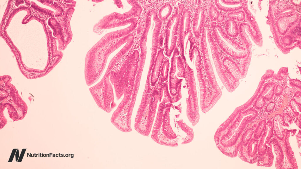 Can Bovine Leukemia Virus Cause Breast Cancer?