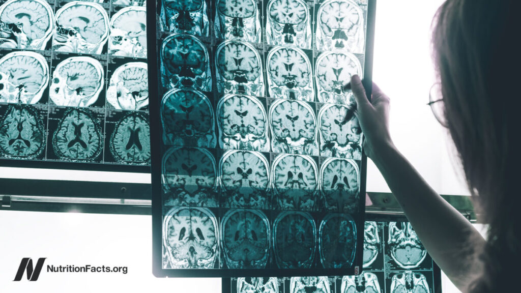 A persistent pesticide linked to Alzheimer’s risk A persistent pesticide linked to Alzheimer's risk